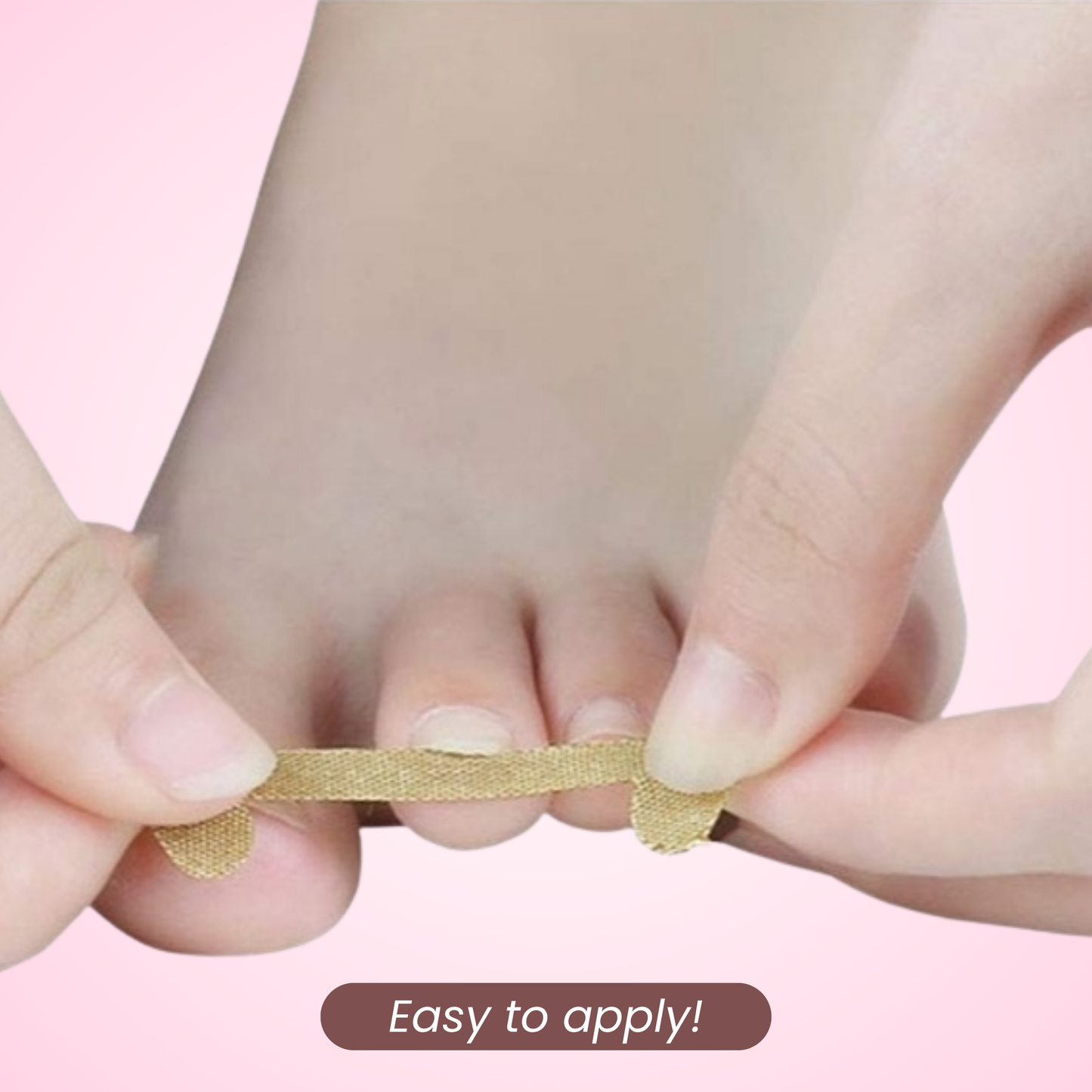 ToeNail - Pro Correction Strips