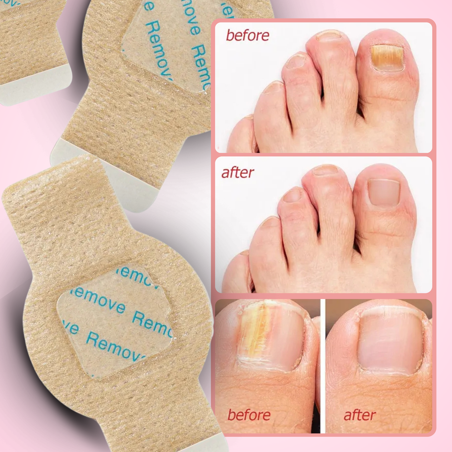 NailAid - Overnight Repair Patches