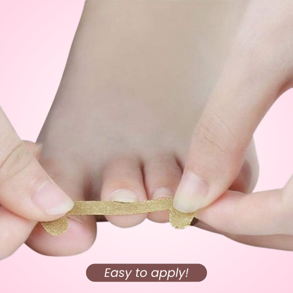 ToeNail - Pro Correction Strips